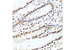 Immunohistochemistry of paraffin-embedded human stomach using METTL3 antibody. (METTL3 anticorps)
