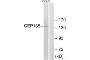 Western blot analysis of extracts from COLO cells, using CEP135 antibody. (CEP135 anticorps  (C-Term))