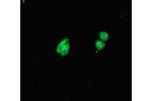 Immunofluorescent analysis of HepG2 cells using ABIN7155018 at dilution of 1:100 and Alexa Fluor 488-congugated AffiniPure Goat Anti-Rabbit IgG(H+L)
