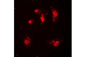 Immunofluorescent analysis of SKP2 staining in HeLa cells. (SKP2 anticorps  (C-Term))