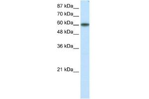 WB Suggested Anti-KLF11 Antibody Titration: 1. (KLF11 anticorps  (N-Term))
