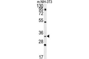Western Blotting (WB) image for anti-Enkurin, TRPC Channel Interacting Protein (ENKUR) antibody (ABIN2997632) (ENKUR anticorps)