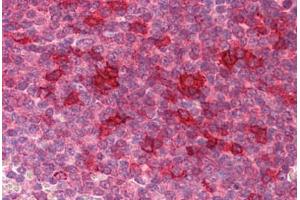 Human Spleen: Formalin-Fixed, Paraffin-Embedded (FFPE) (KLHL25 anticorps  (Internal Region))