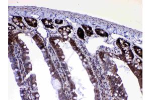 IHC analysis of Ran using anti-Ran antibody .