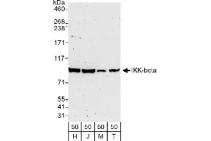 Western Blotting (WB) image for anti-Inhibitor of kappa Light Polypeptide Gene Enhancer in B-Cells, Kinase beta (IKBKB) (AA 706-756) antibody (ABIN7451815)