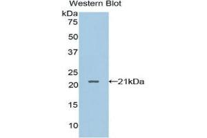 Western Blotting (WB) image for anti-Leukocyte Cell-Derived Chemotaxin 2 (LECT2) (AA 1-151) antibody (ABIN3203619) (LECT2 anticorps  (AA 1-151))