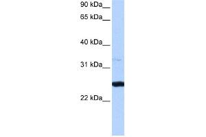 WB Suggested Anti-PRTFDC1 Antibody Titration:  0. (PRTFDC1 anticorps  (Middle Region))
