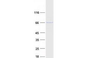 Validation with Western Blot