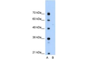 Western Blotting (WB) image for anti-Sep (O-phosphoserine) tRNA:Sec (Selenocysteine) tRNA Synthase (SEPSECS) antibody (ABIN2462350) (SEPSECS anticorps)