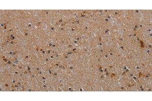 Immunohistochemistry of paraffin-embedded Human brain tissue using p70 S6 kinase beta Polyclonal Antibody at dilution 1:40 (RPS6KB2 anticorps)