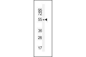 S35E2 Antibody (N-term) (ABIN654754 and ABIN2844438) western blot analysis in HL-60 cell line lysates (35 μg/lane). (SLC35E2 anticorps  (N-Term))