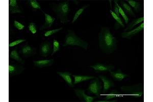 Immunofluorescence of purified MaxPab antibody to BAHD1 on HeLa cell.