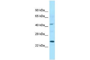 WB Suggested Anti-ISOC1 Antibody Titration: 1. (ISOC1 anticorps  (C-Term))
