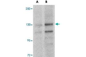 Western blot analysis of FRMPD4 in SK-N-SH cell lysate with FRMPD4 polyclonal antibody  at (A) 1 and (B) 2 ug/mL . (FRMPD4 anticorps  (Internal Region))