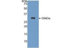 Detection of Recombinant Protein RPB837Mu01 with S-tag using Anti-S15 Oligopeptide (S) Tag Polyclonal Antibody (S15 Oligopeptide anticorps)