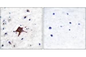 Immunohistochemistry analysis of paraffin-embedded human brain tissue, using GLUT3 Antibody. (SLC2A3 anticorps  (AA 447-496))