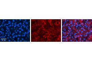 ACSL1 antibody - C-terminal region          Formalin Fixed Paraffin Embedded Tissue:  Human Liver Tissue    Observed Staining:  Cytoplasm in hepatocytes   Primary Antibody Concentration:  1:600    Secondary Antibody:  Donkey anti-Rabbit-Cy3    Secondary Antibody Concentration:  1:200    Magnification:  20X    Exposure Time:  0.
