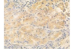 ABIN6266341 and ABIN6277067 at 1/100 staining human normal gastric tissue by IHC-P. (GSK3 alpha/beta anticorps  (N-Term))