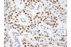 Immunohistochemistry (IHC) image for anti-A Kinase (PRKA) Anchor Protein 8-Like (AKAP8L) (AA 596-646) antibody (ABIN7448929) (AKAP8L anticorps  (AA 596-646))