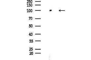 anti-Chromodomain Helicase DNA Binding Protein 1-Like (CHD1L) (Internal Region) antibody