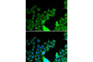 Immunofluorescence analysis of HeLa cells using BCL2L14 antibody. (BCL2L14 anticorps)