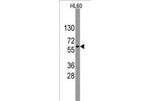 Western blot analysis of anti-GNL3 Antibody (Center) (R) in HL60 cell line lysates (35 μg/lane). (Nucleostemin anticorps  (AA 191-220))