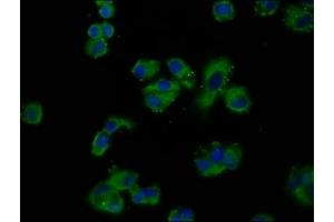 Immunofluorescence staining of MCF-7 cells with ABIN7165031 at 1:200, counter-stained with DAPI.