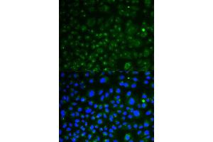 Immunofluorescence analysis of HeLa cell using LAMP1 antibody. (LAMP1 anticorps  (AA 80-280))