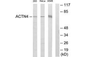 Western blot analysis of extracts from 293/HeLa/A549 cells, using ACTN1/2/3/4 Antibody.