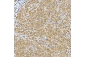 Immunohistochemistry of paraffin-embedded rat ovary using DC Rabbit mAb (ABIN7266685) at dilution of 1:200 (40x lens). (DCAF7 anticorps)