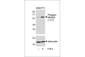 Western blot analysis of lysates from NIH/3T3 cell line, untreated or treated with TGF-β(100 ng/mL, 30 min), using Phospho-SD4 Antibody (upper) or Beta-actin (lower). (SMAD4 anticorps  (pThr277))