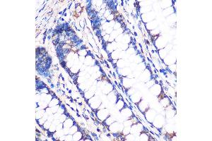 Immunohistochemistry of paraffin-embedded Human colon using NDUFL2 Rabbit pAb (ABIN7268803) at dilution of 1:100 (40x lens). (NDUFA4L2 anticorps  (AA 1-87))