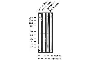 Western blot analysis of Phospho-Fos (Ser362) expression in various lysates (c-FOS anticorps  (pSer362))