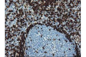 Image no. 5 for anti-GTPase, IMAP Family Member 4 (GIMAP4) antibody (ABIN1498460)