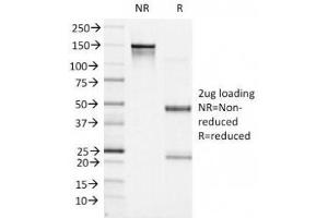 SDS-PAGE Analysis of Purified, BSA-Free Bcl6 Antibody (clone BCL6/1527). (BCL6 anticorps  (AA 256-389))