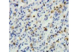 IHC-P analysis of Spleen tissue, with DAB staining. (TCL1A anticorps  (AA 1-114))