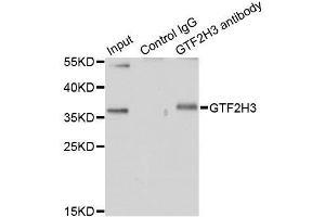 Immunoprecipitation analysis of 200ug extracts of HT-29 cells using 1ug GTF2H3 antibody. (GTF2H3 anticorps  (AA 1-308))