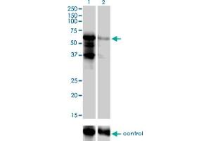 Western blot analysis of PKNOX2 over-expressed 293 cell line, cotransfected with PKNOX2 Validated Chimera RNAi (Lane 2) or non-transfected control (Lane 1).