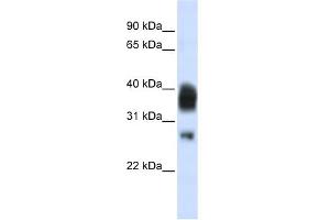 WB Suggested Anti-RNASEH1 Antibody Titration:  0. (Ribonuclease H1 anticorps  (Middle Region))