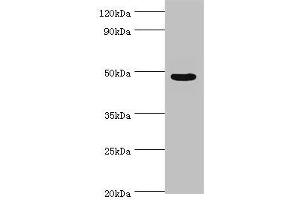 Western blot All lanes: Evolutionarily conserved signaling intermediate in Toll pathway, mitochondrial antibody at 10 μg/mL + Jurkat whole cell lysate Secondary Goat polyclonal to rabbit IgG at 1/10000 dilution Predicted band size: 50, 34, 25 kDa Observed band size: 50 kDa (ECSIT anticorps  (AA 185-431))