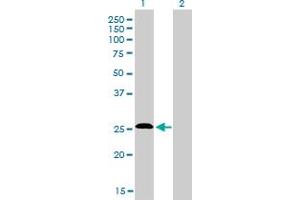 Western Blot analysis of C20orf18 expression in transfected 293T cell line by C20orf18 monoclonal antibody (M01), clone 3C3. (RBCK1 anticorps  (AA 3-99))