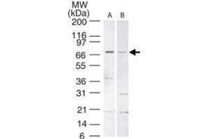 Western blot analysis of Ticam1 in mouse spleen lysate. (TICAM1 anticorps  (AA 143-158))