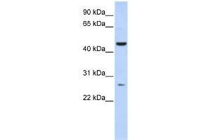 WB Suggested Anti-C6orf199 Antibody Titration: 0. (AKD1 anticorps  (Middle Region))