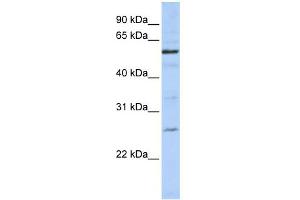 WB Suggested Anti-ZGPAT Antibody Titration:  0.