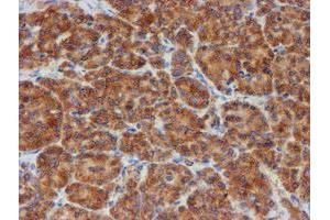 Image no. 7 for anti-Sec1 Family Domain Containing 1 (SCFD1) antibody (ABIN1500819)