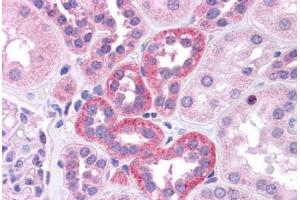 Human Kidney: Formalin-Fixed, Paraffin-Embedded (FFPE)