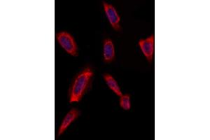 ABIN6259341 and ABIN6275460 staining Hela by IF/ICC.