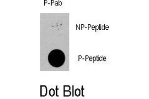 Image no. 1 for anti-3-phosphoinositide Dependent Protein Kinase-1 (PDPK1) (pSer396) antibody (ABIN358390) (PDPK1 anticorps  (pSer396))