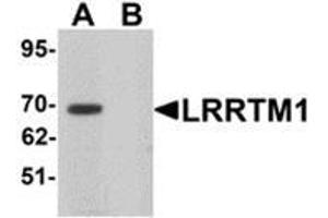 Western blot analysis of LRRTM1 in mouse brain tissue lysate with LRRTM1 antibody at 1 μg/ml in (A) the absence and (B) the presence of blocking peptide. (LRRTM1 anticorps  (C-Term))
