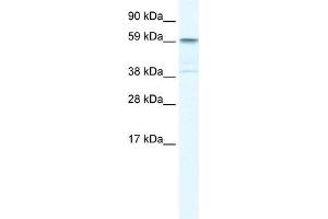 Human Liver; WB Suggested Anti-TRIM41 Antibody Titration: 0. (TRIM41 anticorps  (C-Term))